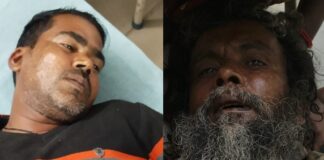 बाइक अनियंत्रित होने से राहगीर व बाइक सवार घायल